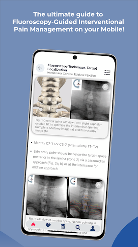 Interventional Pain App スクリーンショット 4