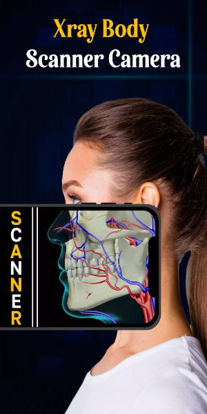 X Ray Mobile v.2.0 Schermafbeelding 2