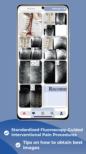 Interventional Pain App スクリーンショット 3